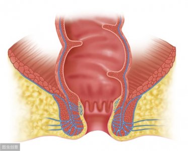 ​肛瘘是什么症状 出现这4个症状，怕是已”躺中”肛瘘，肛瘘不做手术可以自愈吗