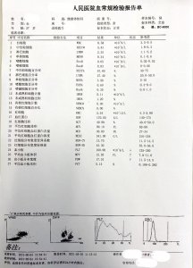 ​血常规报告单图片 血常规报告单正常值