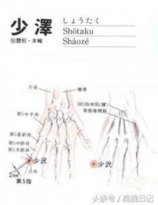 ​人体穴位大全-少泽穴：头痛、脑血管病、咽炎、扁桃体炎等